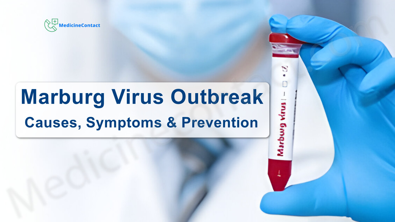 The Marburg Virus Outbreak: Causes, Symptoms, and Prevention