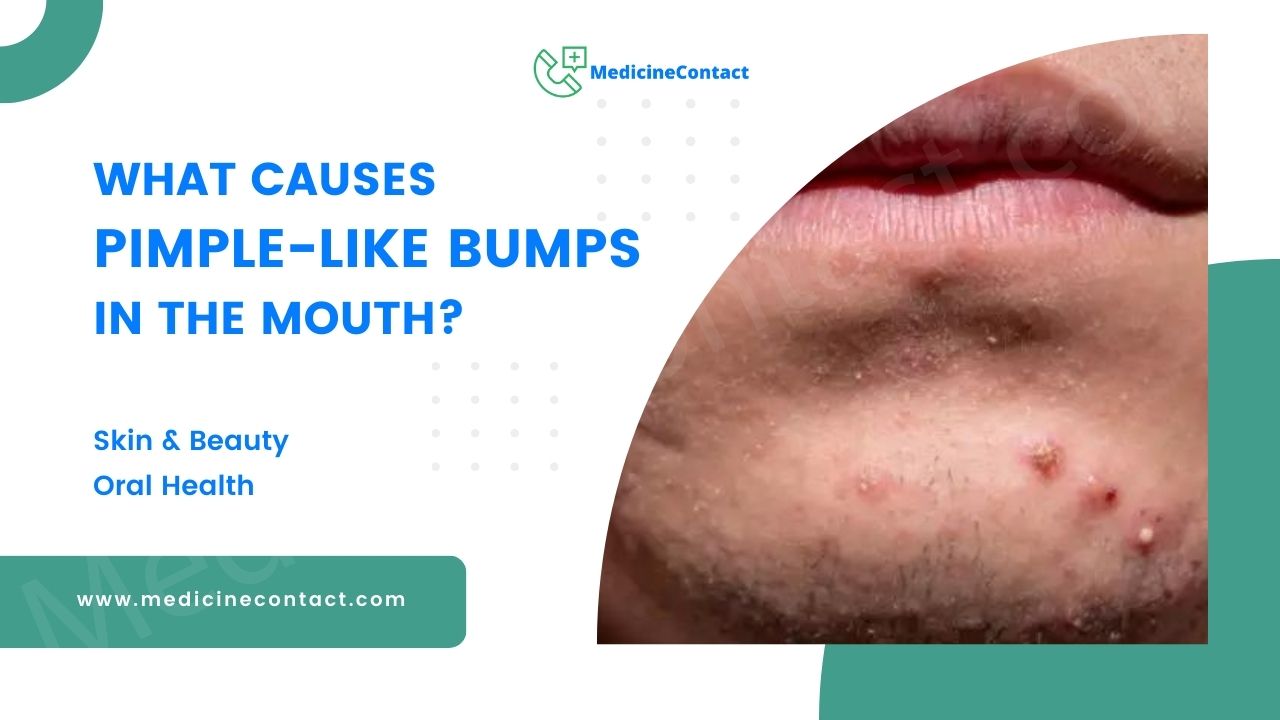 What Causes Pimple-Like Bumps in the Mouth?