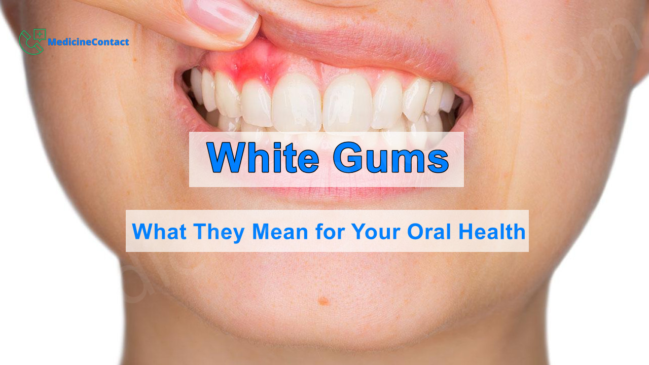 White Gums: What They Mean for Your Oral Health